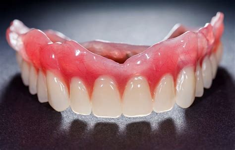 The long-term problems with ill-fitting dentures | Deeragun Dental