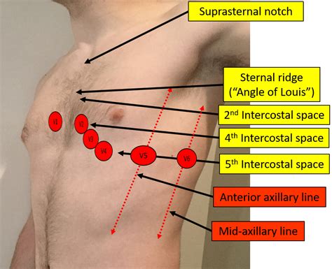 12 Lead Ekg Placement Diagram With Heart