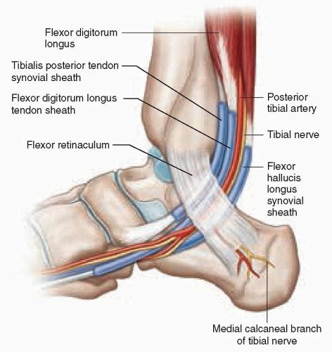 Podiatric Associates Foot & Ankle Center | Tarsal Tunnel Syndrome in ...