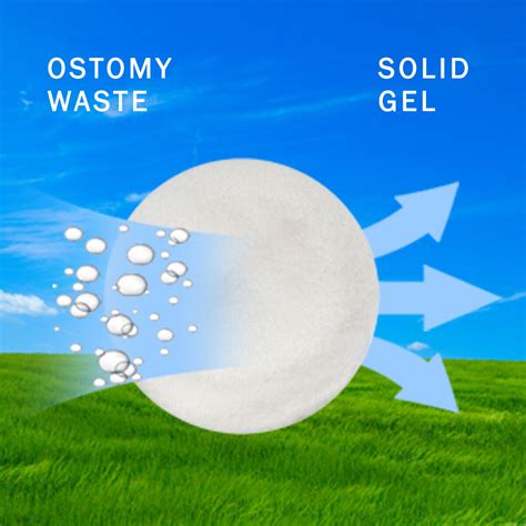 SMELLEZE Ostomy Bag Odor Eliminator: 50 lb. Granules Remove Colostomy ...