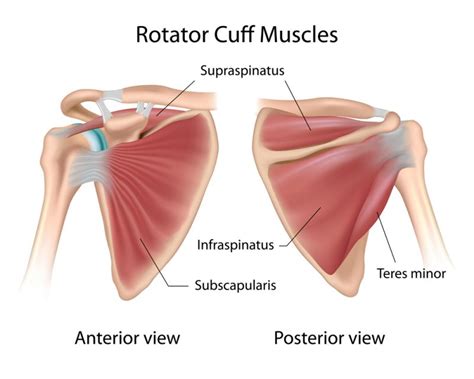 How To Relieve Frozen Shoulder Pain in the Subscapularis