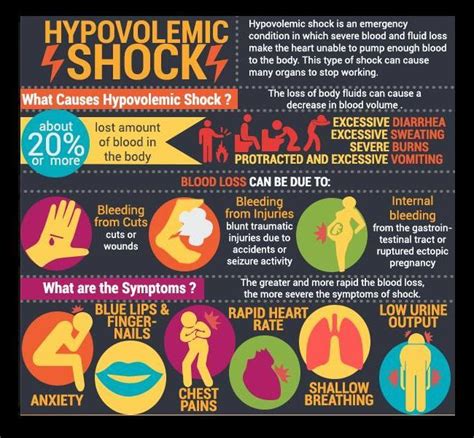 Hypovolemic shock | Nursing Study Aids/Mnemonics | Pinterest