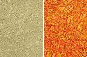 Bovine Pulmonary Artery Smooth Muscle Cells (BPASMC), Cell Applications, Inc. | VWR