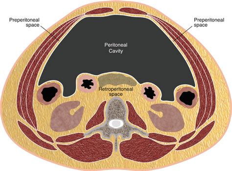 The Extraperitoneal Spaces | SpringerLink