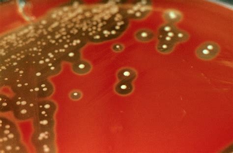 Streptococcus Pyogenes Colonies On Blood Agar | The Best Porn Website