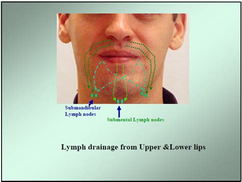 Dentistry lectures for MFDS/MJDF/NBDE/ORE: lymphatic drainage of the oral structures- mcq review