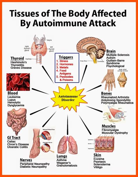 Discover Why You Have An Autoimmune Disease and The Road To Recovery ...