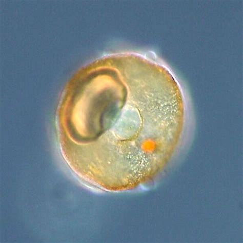 Arcella sp - testate amoebae - Wikipedia | Microscopic photography, Science nature, Single celled