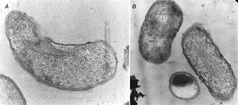 Ultrastructure of sulfate-reducing bacteria cells (electron microscopy,... | Download Scientific ...