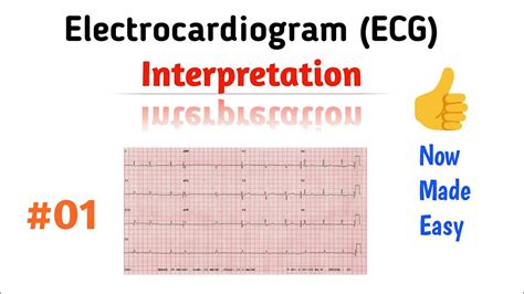 How to Read an ECG (Interpretation) | 01 Rhythm - YouTube