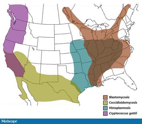 Image result for histoplasmosis blastomycosis coccidioidomycosis map | Med id, Map, Image