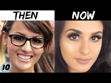 Sssniperwolf Plastic Surgery – Telegraph