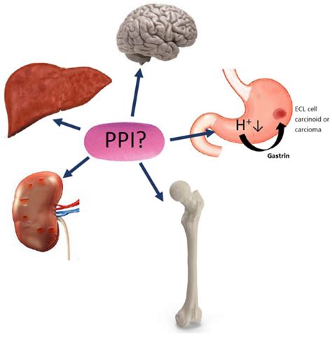 IJMS | Free Full-Text | Adverse Effects of Proton Pump Inhibitors—Evidence and Plausibility