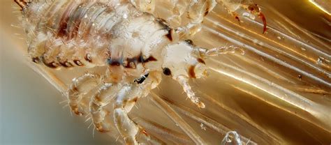 The Dreaded, Itchy Head Louse | Critter Science