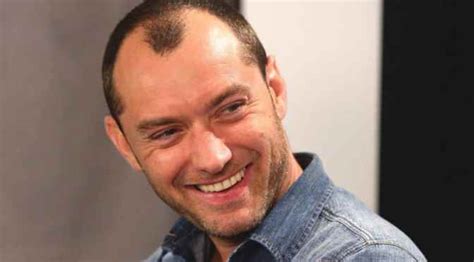 15 Marvelous Hairstyles For Balding Men - Hottest Haircuts