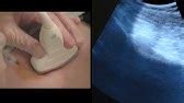 ST - How to: Ultrasound Guided Hip Injection - YouTube