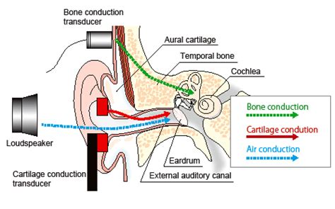 Cartilage conduction hearing aids: the third pathway for sound transmission and its application ...