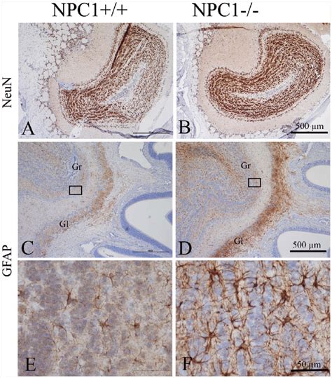 Immunohistochemistry of NeuN (A, B) and GFAP (C through F) in the OB ...