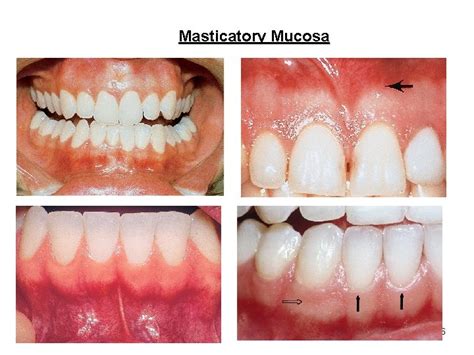 Oral Mucosa Part 1 1 Oral Mucosa Mucous