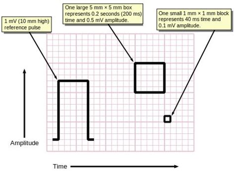 1 Small Box Ecg - LondonaresSanders