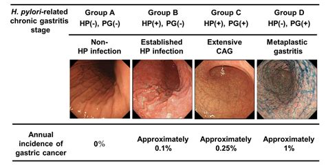 Stage 4 Stomach Cancer Symptoms - CancerWalls