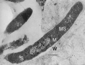 Modern Treatments for Leprosy - microbewiki