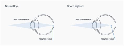 Getting the Best Lenses for Your Prescription — Zac's Optical