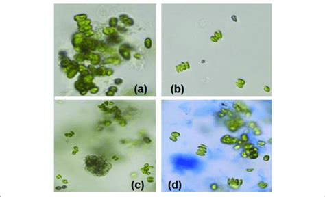 | Microscopic images (at 40X magnification) after settling process with... | Download Scientific ...