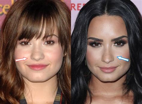 Did Demi Lovato Have Cosmetic Surgery? (Before & After 2022)