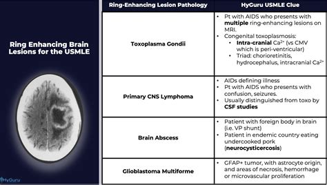 Ring Enhancing Brain Lesion for the USMLE (DDx) : r/Step2