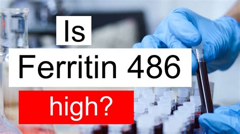 Is Ferritin 486 high, normal or dangerous? What does Ferritin level 486 mean?