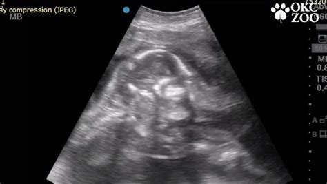 WATCH: OKC Zoo shares ultrasound video of baby elephant due in February 2022