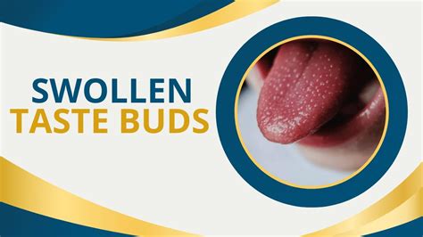 Swollen Taste Buds: 6 Signs and Symptoms and Their Cure - YouTube