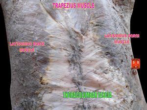 Thoracolumbar Fascia - Physiopedia