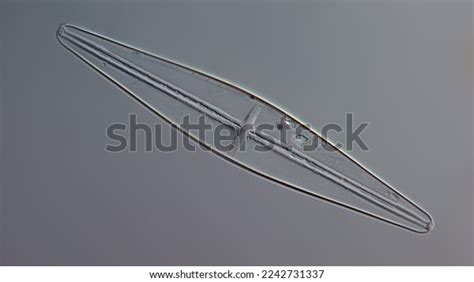 Diatom Cell Under Dic Microscope Stock Photo 2242731337 | Shutterstock