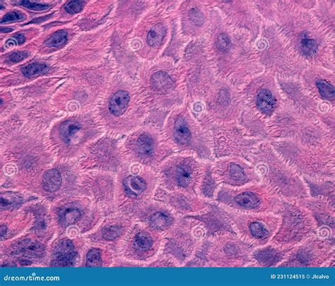 Epidermis. Stratum Spinosum. Desmosomes Stock Image - Image of cytology ...