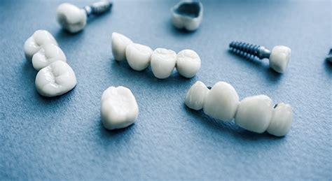 Ensuring Successful Implant Maintenance - Dimensions of Dental Hygiene | Magazine