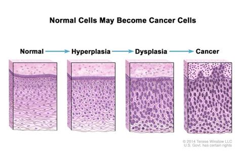 Describe Two Reasons Why Cells Can Form Tumors.