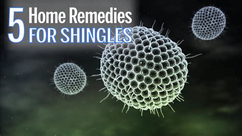 Home Remedies and Natural Treatment Of Shingles – Truebodyhack.com