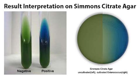 Simmons Citrate Agar (SCA) - Definisi, Komposisi, Cara Pembuatan dan ...