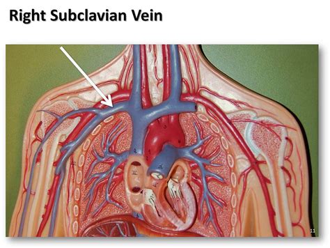 Right subclavian vein - The Anatomy of the Veins Visual Gu… | Flickr