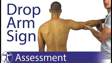 Drop Arm Test / Sign | Supraspinatus Tear - YouTube