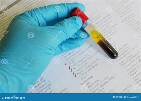 Thyroid hormone testing stock image. Image of test, medical - 57917151