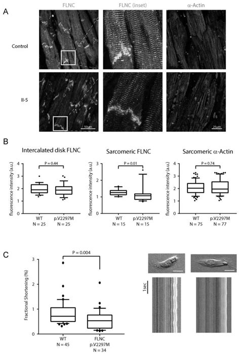 Novel Mutation in FLNC (Filamin C) Causes Familial Restrictive ...