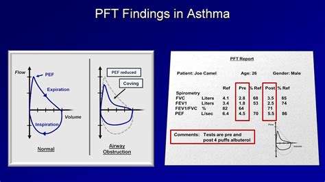 Differentiate Copd And Asthma - Asthma / They can have similar symptoms, including breathing ...