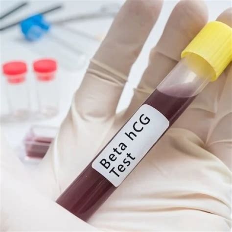 Beta HCG Test 1S - Pharma Xonline