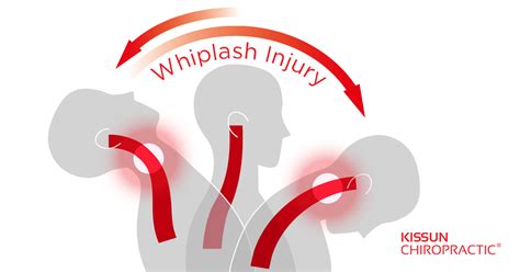 10 Side Effects of Whiplash Injury