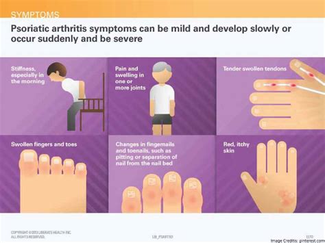 Psoriatic Arthritis - Symptoms, Causes, Treatment & More