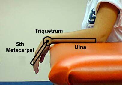 Goniometer of wrist flexion (80): over triquetrum (falcrum), lateral ...