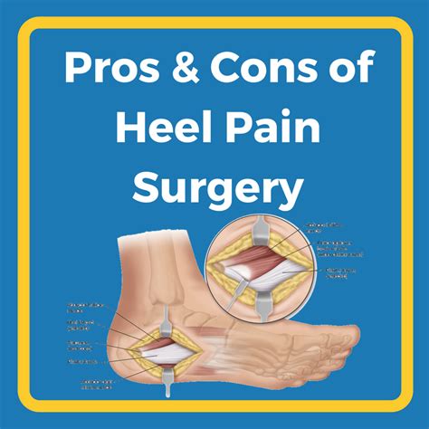 Plantar Fascia Surgery